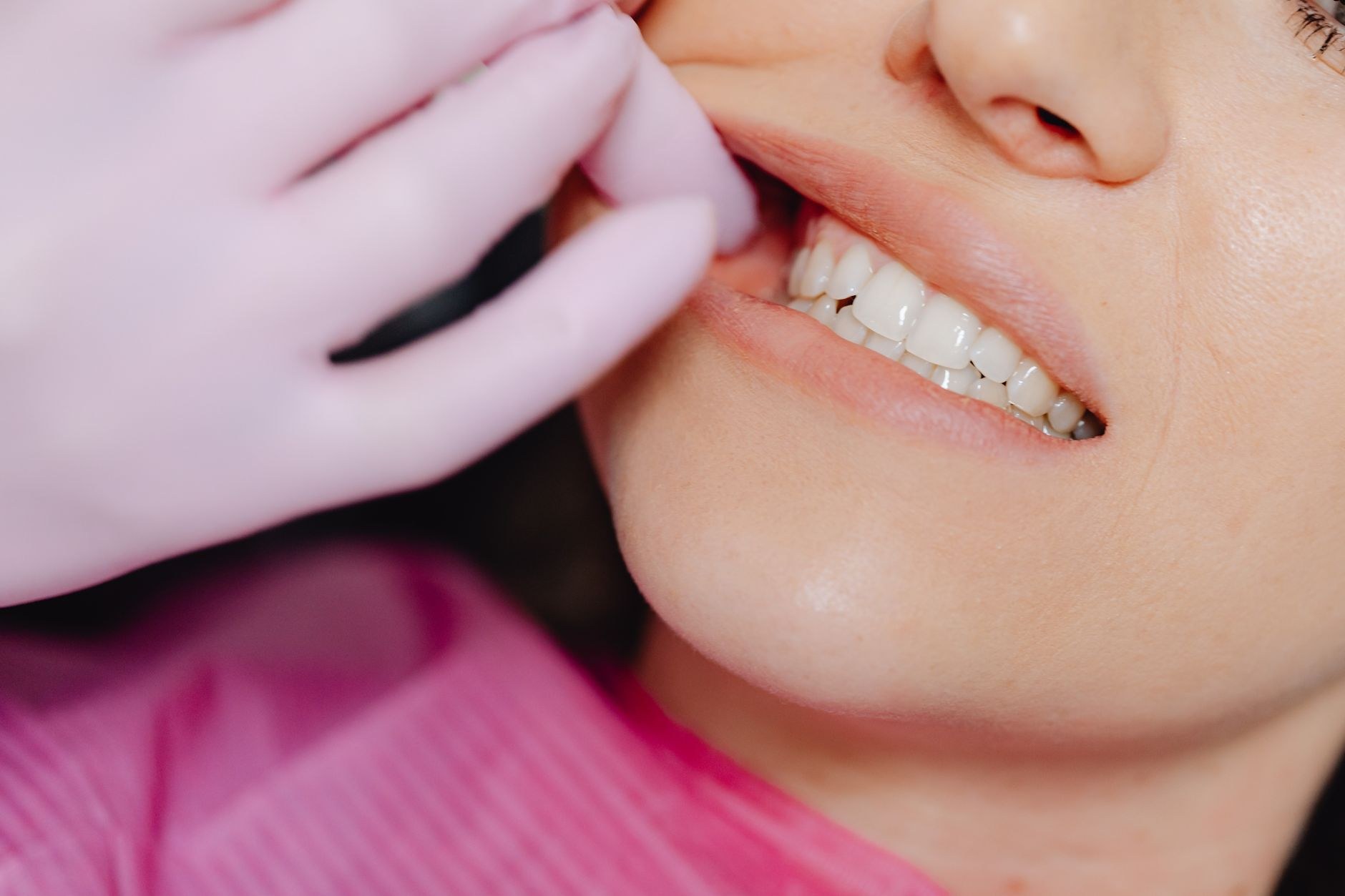 Close-up of teeth during a tooth-gem placement