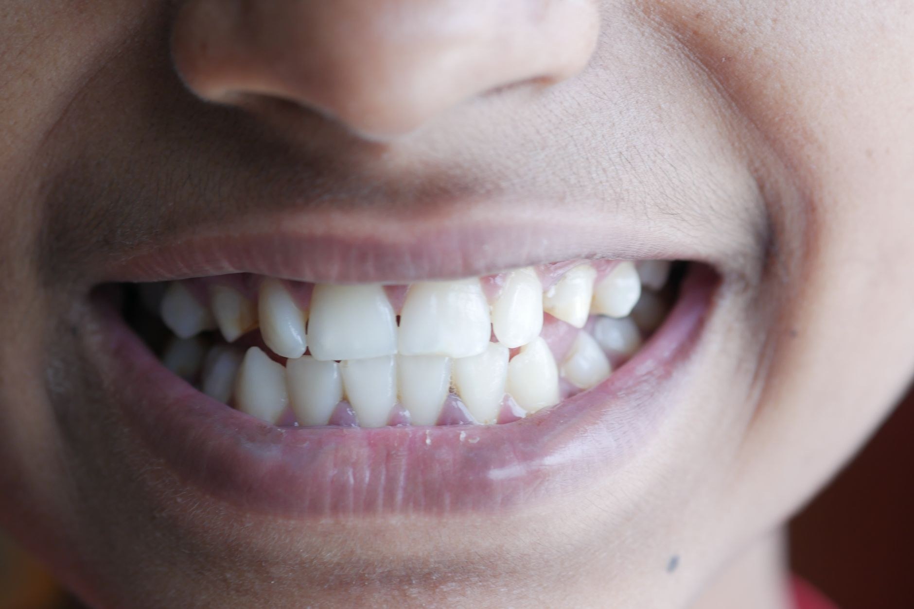 Radiant natural white smile in close-up